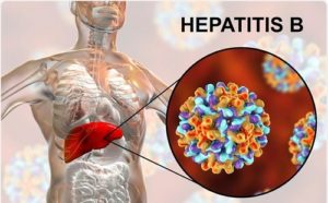 Hepatitis B Treatment